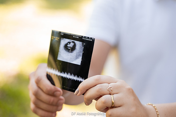 0040 - Márcia e Thiago - Chá Revelação - DF4_4691